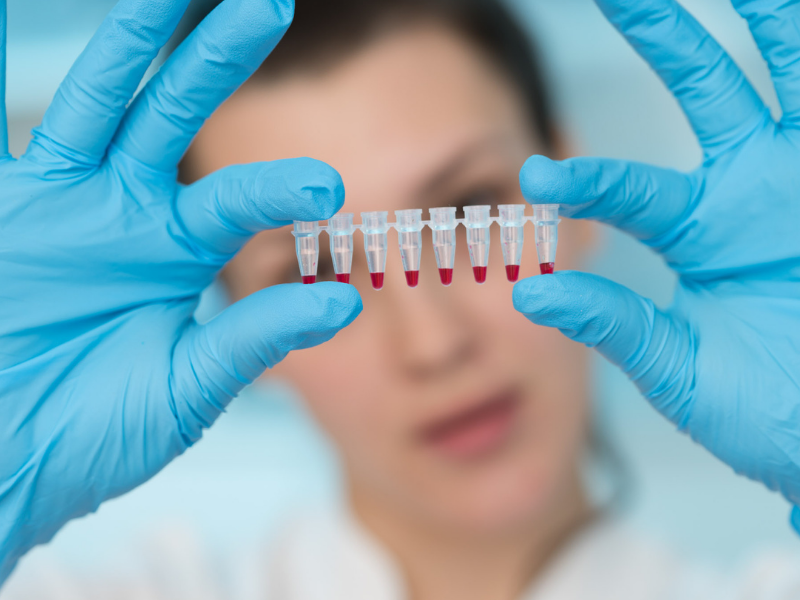 I Dati Sul Tumore Raro In Italia Sophos Biotech Srl